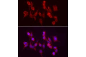 Immunofluorescence analysis of PC-12 cells using /GSNOR Rabbit pAb (ABIN6131172, ABIN6136579, ABIN6136580 and ABIN6217464) at dilution of 1:50 (40x lens). (ADH5 anticorps  (AA 1-374))