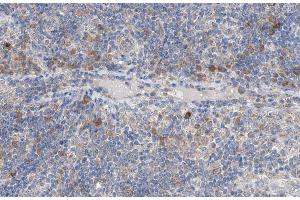ABIN6266950 at 1/100 staining human lymph node tissue sections by IHC-P. (NCK2 anticorps  (Internal Region))