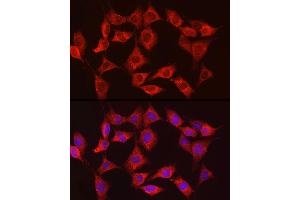Immunofluorescence analysis of NIH/3T3 cells using HK3 Rabbit pAb (ABIN6131756, ABIN6141801, ABIN6141802 and ABIN6224488) at dilution of 1:150 (40x lens). (HK3 anticorps  (AA 1-270))