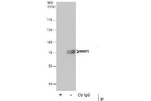 IP Image Immunoprecipitation of MMP2 protein from U87-MG whole cell extracts using 5 μg of MMP2 antibody, Western blot analysis was performed using MMP2 antibody, EasyBlot anti-Rabbit IgG  was used as a secondary reagent.