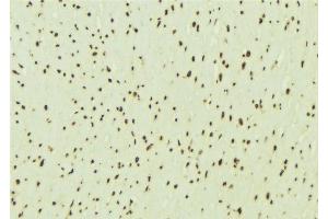 ABIN6276464 at 1/100 staining Mouse brain tissue by IHC-P.