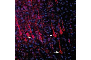 Expression of P2RY6 in rat parietal cortex - Immunohistochemical staining of perfusion-fixed frozen rat brain sections with Anti-P2Y6 Receptor (extracellular) Antibody (ABIN7043591, ABIN7045140 and ABIN7045141), (1:1000), followed by donkey-anti-rabbit-biotin and streptavidin-Cy3.