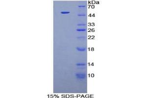 SDS-PAGE analysis of Human FGF6 Protein. (FGF6 Protéine)