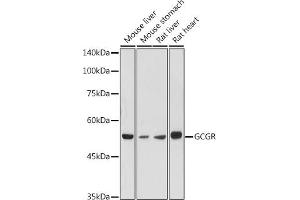 Western blot analysis of extracts of various cell lines, using GCGR antibody (ABIN7267394) at 1:1000 dilution. (Glucagon Receptor anticorps  (AA 1-140))