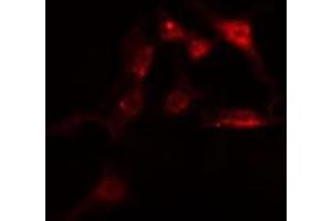 ABIN6275142 staining  HeLa cells by IF/ICC. (IFI16 anticorps  (C-Term))