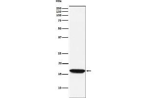 Western blot analysis of NM23A expression in Jurkat cell lysate.
