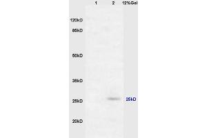 Lane 1: mouse embryo lysates Lane 2: mouse brain lysates probed with Anti RASSF3 Polyclonal Antibody, Unconjugated (ABIN762101) at 1:200 in 4 °C. (RASSF3 anticorps  (AA 51-150))
