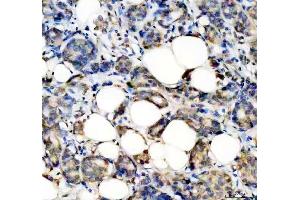 anti-Signal Transducer and Activator of Transcription 2, 113kDa (STAT2) antibody