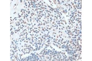 Immunohistochemistry of paraffin-embedded Human appendix using ZNF433 Polyclonal Antibody at dilution of 1:100 (40x lens). (ZNF433 anticorps)