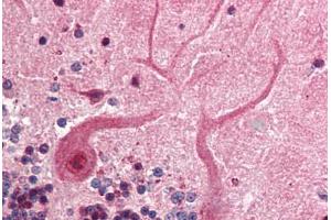 Human Brain, Cerebellum (formalin-fixed, paraffin-embedded) stained with SKP1 antibody ABIN218526 at 1:500 followed by biotinylated goat anti-rabbit IgG secondary antibody ABIN481713, alkaline phosphatase-streptavidin and chromogen. (SKP1 anticorps  (C-Term))