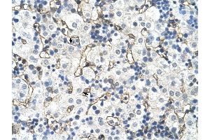 SLC39A5 antibody was used for immunohistochemistry at a concentration of 4-8 ug/ml to stain Hepatocytes (arrows) in Human Liver. (SLC39A5 anticorps)