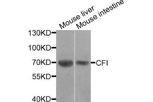Western blot analysis of extracts of various cell lines, using CFI antibody. (Complement Factor I anticorps)