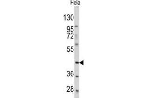 Western Blotting (WB) image for anti-Platelet-Derived Growth Factor Receptor-Like (PDGFRL) antibody (ABIN3003406) (PDGFRL anticorps)
