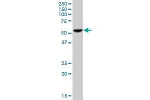 PHGDH MaxPab polyclonal antibody.