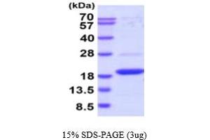 SDS-PAGE (SDS) image for Dual Specificity Phosphatase 23 (DUSP23) (AA 1-150) (Active) protein (His tag) (ABIN6388007)