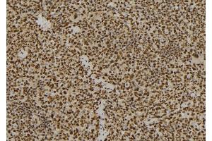 ABIN6264491 and ABIN6277541 at 1/100 staining Mouse spleen tissue by IHC-P.