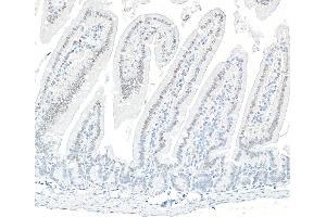 Immunohistochemistry (IHC) image for anti-AT Rich Interactive Domain 1B (SWI1-Like) (ARID1B) (AA 1425-1475) antibody (ABIN7795694)
