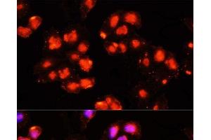 Immunofluorescence analysis of HeLa cells using HOXB9 Polyclonal Antibody at dilution of 1:100 (40x lens). (HOXB9 anticorps)