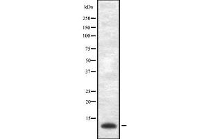 Western blot analysis of VAMP-1/2/3 using Jurkat whole cell lysates (Vamp-1+2+3 anticorps)