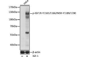 Western blot analysis of extracts of HeLa cells, using Phospho-IGF1R-Y1165/1166/INSR-Y1189/1190 pAb (ABIN7267900) at 1:1000 dilution.