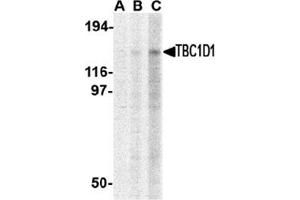 Western blot analysis of TBC1D1 in Daudi cell lysate with this product at (A) 1, (B) 2 and (C) 4 μg/ml. (TBC1D1 anticorps  (C-Term))