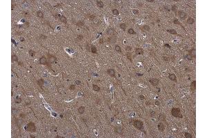 IHC-P Image RPS3 antibody detects RPS3 protein at cytoplasm in rat brain by immunohistochemical analysis.