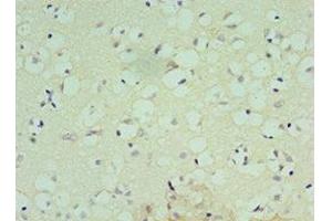 Immunohistochemistry of paraffin-embedded human brain tissue using ABIN7148809 at dilution of 1:100 (AFT7 anticorps  (AA 1-117))