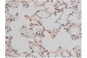 ABIN6267437 at 1/200 staining Rat lung tissue sections by IHC-P. (RPS6KB1 anticorps  (pThr229))
