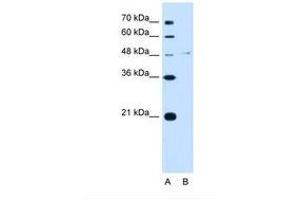 Image no. 1 for anti-Olfactomedin 4 (OLFM4) (C-Term) antibody (ABIN321838) (Olfactomedin 4 anticorps  (C-Term))