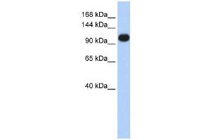 ATP2A3 antibody used at 1 ug/ml to detect target protein. (ATP2A3 anticorps  (Middle Region))