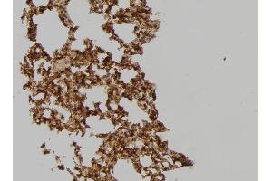 ABIN6259350 and ABIN6275567 at 1/100 staining Mouse lung tissue by IHC-P. (SH3GLB2 anticorps  (C-Term))