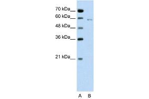WB Suggested Anti-CDC23  Antibody Titration: 0. (CDC23 anticorps  (C-Term))