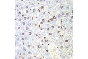 Immunohistochemistry of paraffin-embedded mouse liver using UHRF2 antibody at dilution of 1:200 (400x lens). (UHRF2 anticorps)