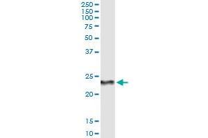 Immunoprecipitation of RCVRN transfected lysate using anti-RCVRN monoclonal antibody and Protein A Magnetic Bead , and immunoblotted with RCVRN MaxPab rabbit polyclonal antibody.