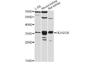 Western blot analysis of extracts of various cell lines, using HLA-DOB antibody (ABIN5997900) at 1:3000 dilution.