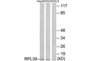 Western blot analysis of extracts from COLO/HepG2 cells, using RPL39 Antibody. (RPL39 anticorps  (AA 1-50))