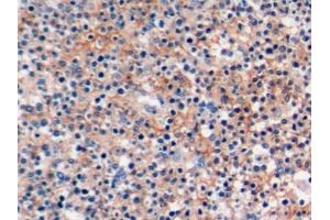 Detection of PDL2 in Human Tonsil Tissue using Polyclonal Antibody to Programmed Cell Death Protein 1 Ligand 2 (PDL2) (PDCD1LG2 anticorps  (AA 33-236))