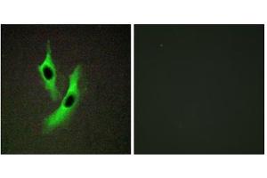 Immunofluorescence analysis of Jurkat cells, using STEAP4 antibody. (STEAP4 anticorps  (Internal Region))