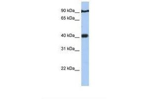 Image no. 1 for anti-Prostate Tumor Overexpressed 1 (PTOV1) (AA 110-159) antibody (ABIN6738729)