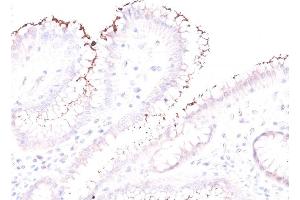 Formalin-fixed, paraffin-embedded human Stomach stained with Helicobacter pylori Rabbit PAb. (Helicobacter Pylori anticorps)
