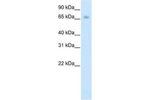 Western Blotting (WB) image for anti-Kelch-like protein 41 (KLHL41) antibody (ABIN2461774)