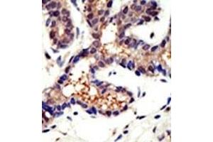 Image no. 1 for anti-Ubiquilin 3 (UBQLN3) (N-Term) antibody (ABIN357613) (Ubiquilin 3 anticorps  (N-Term))