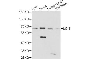 Western blot analysis of extracts of various cell lines, using LGI1 antibody (ABIN1876596) at 1:3000 dilution. (LGI1 anticorps)