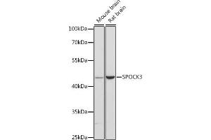 Western blot analysis of extracts of various cell lines, using SPOCK3 antibody (ABIN6131057, ABIN6148367, ABIN6148368 and ABIN6216626) at 1:3000 dilution.
