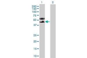 Lane 1: PSG9 transfected lysate ( 48. (PSG9 293T Cell Transient Overexpression Lysate(Denatured))