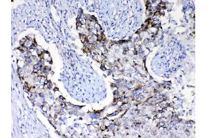 IHC analysis of PIK3CB using anti- PIK3CB antibody .