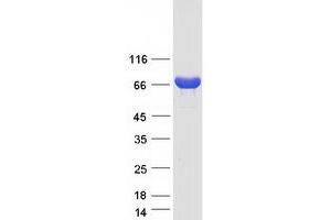 Validation with Western Blot