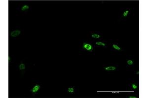 Immunofluorescence of monoclonal antibody to DLX2 on HeLa cell.