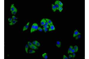 Immunofluorescence staining of HepG2 cells with ABIN7173382 at 1:166, counter-stained with DAPI. (TREM2 anticorps  (AA 19-174))