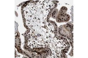 Immunohistochemical staining of human placenta with ZNF250 polyclonal antibody  shows strong nuclear positivity in trophoblastic cells at 1:50-1:200 dilution. (ZNF250 anticorps)